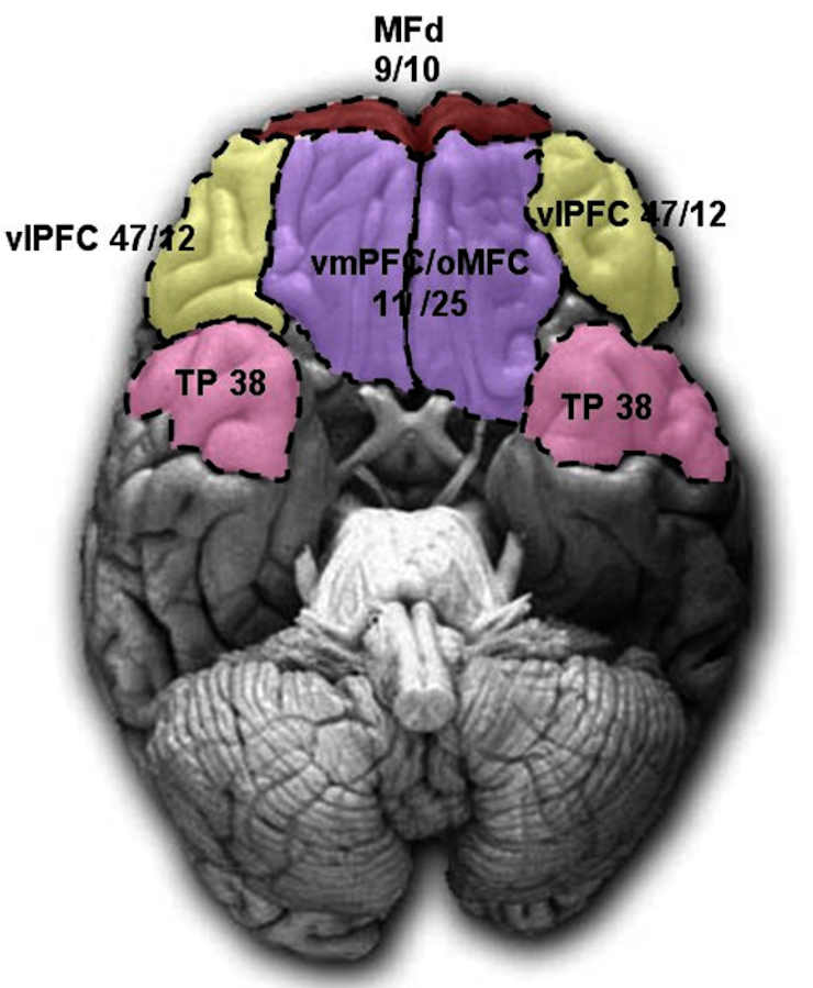 ventromedial prefrontal cortex (vmPFC)