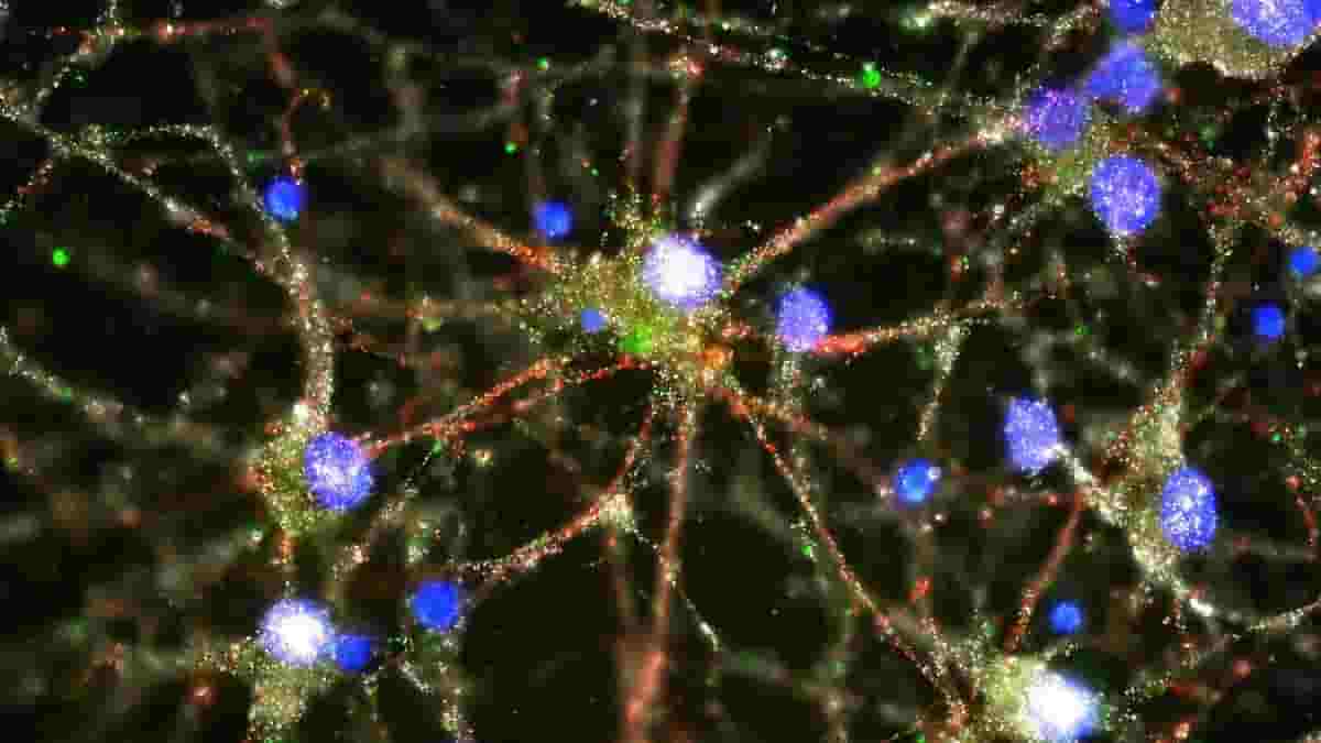 maging studies showed C4 (in green) located at the synapses of primary human neurons
