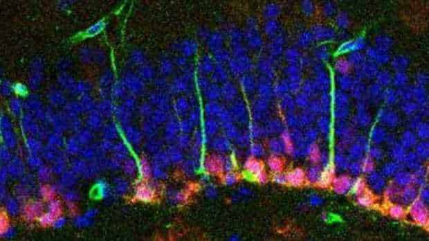 neural stem cells