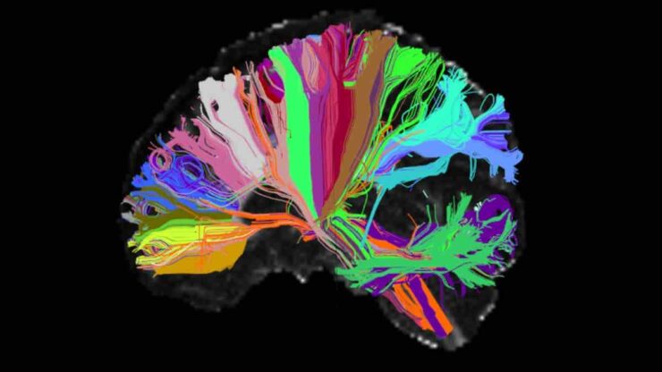 High Angular Resolution Diffusion Image of human brain
