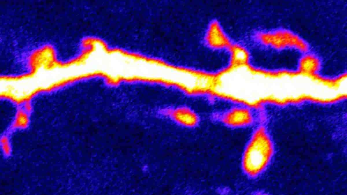 Dendritic spines, structures that are important for neurotransmission, jut out of an AgRP neuron