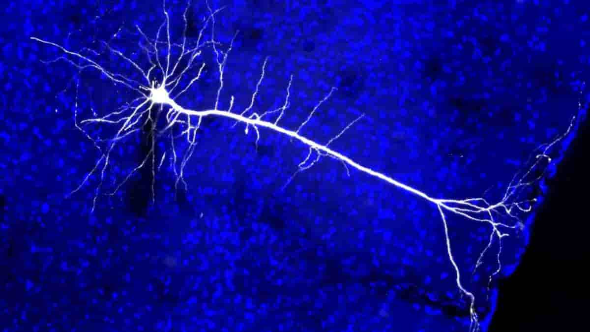 visual cortex nerve projection