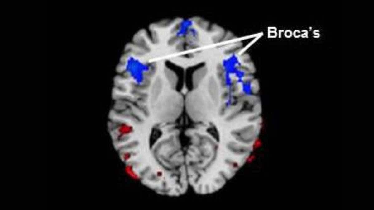 Broca's area, located in the frontal lobe of brain