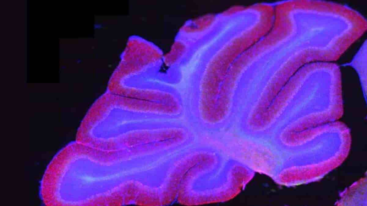 cross-section of a rodent cerebellum stained to show cell bodies