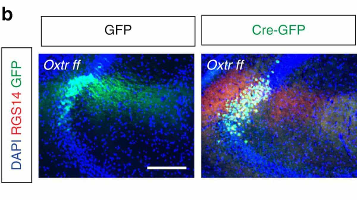 Cre and GFP virus infection in aCA2