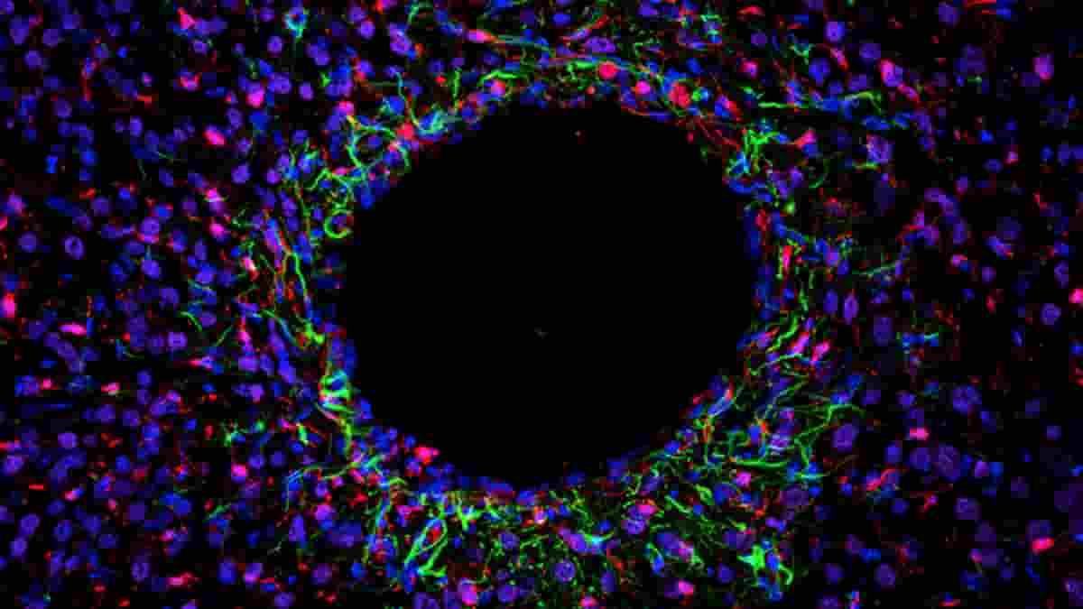 probes developed at MIT cause minimal injury to brain tissue