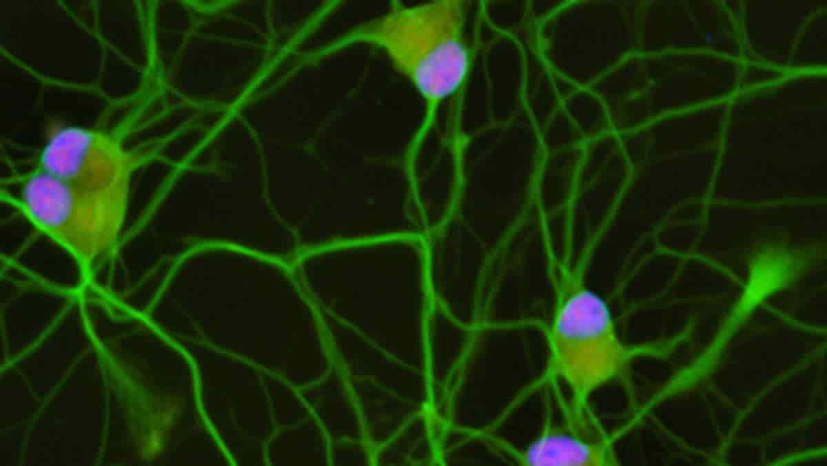 STMN2 Gene A Potential Therapeutic Target For ALS