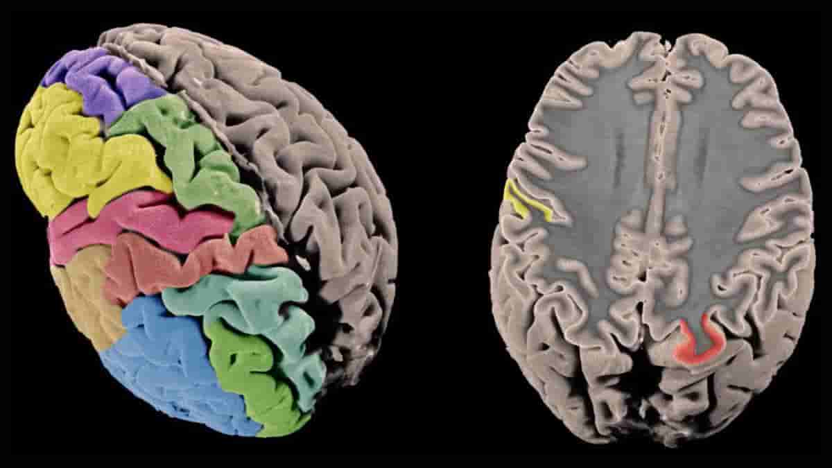 cerebral cortex surface map