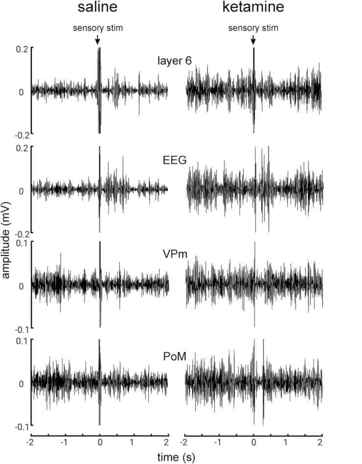 Pre-stimulus beta and gamma frequencies on cortical and thalamic recordings