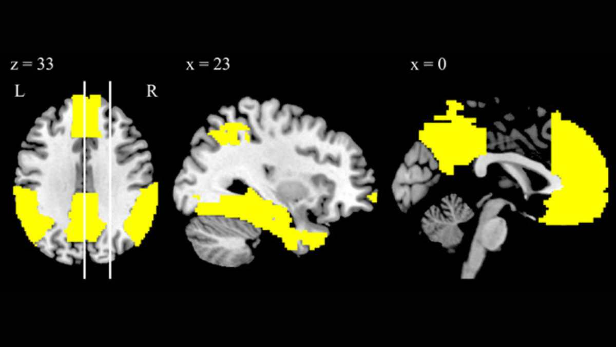 brain default mode network anatomy