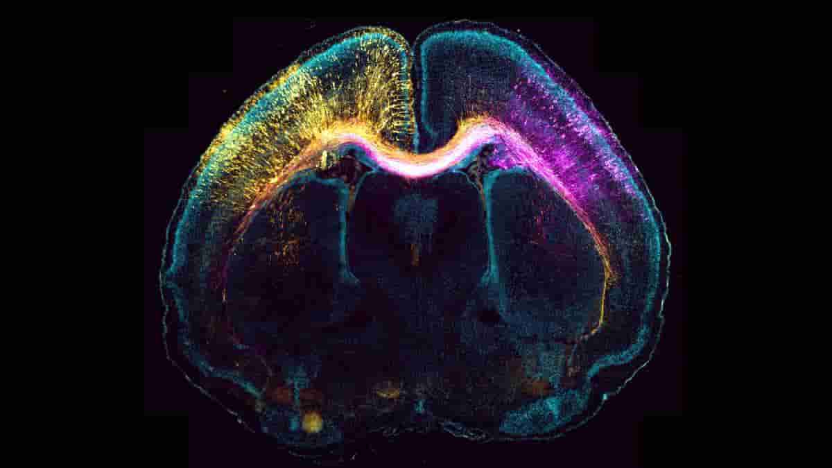Microscope image of a mouse brain that was genetically changed in its embryonic stage.
