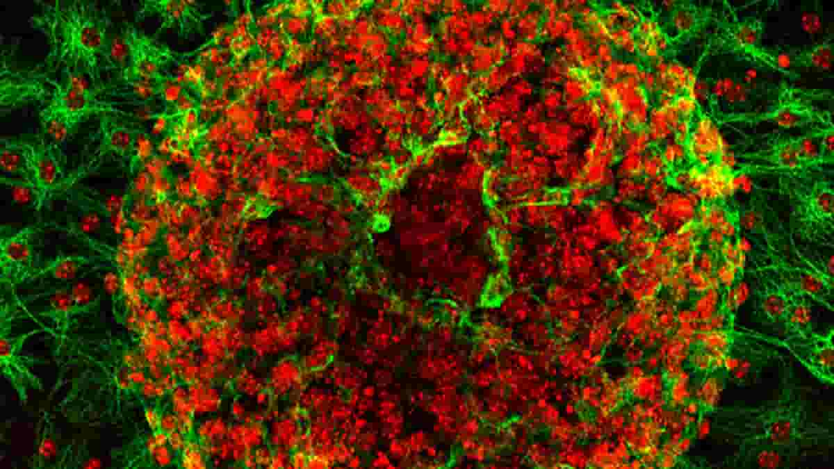 mouse brain astrocytes