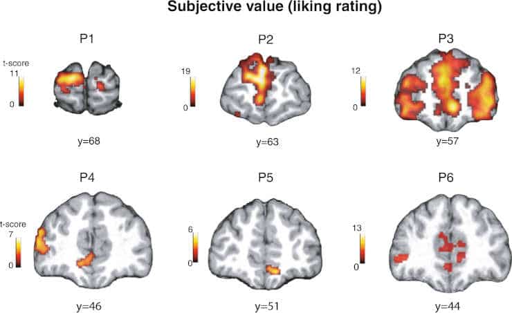 Subjective value for art stimuli at the time of stimulus onset