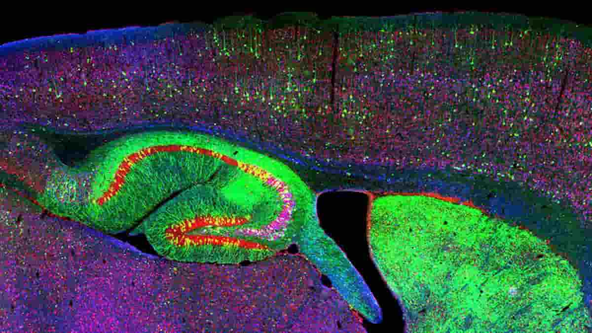 Hippocampus and neurons of mouse with the neurodegenerative disease Niemann-Pick type C1
