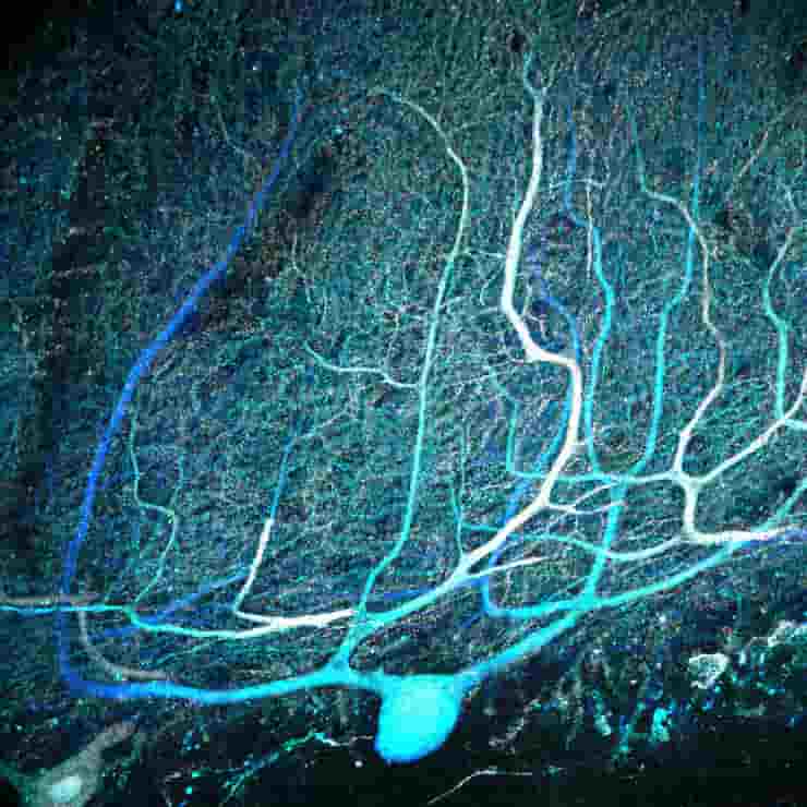 human purkinje cells in the cerebellum