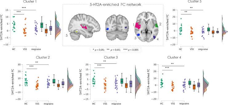 Clusters of significantly reduced serotonergic-enriched functional connectivity in all patients with VSS (n = 23) and patients with MIG (n = 25) with respect to HCs (n = 21). 