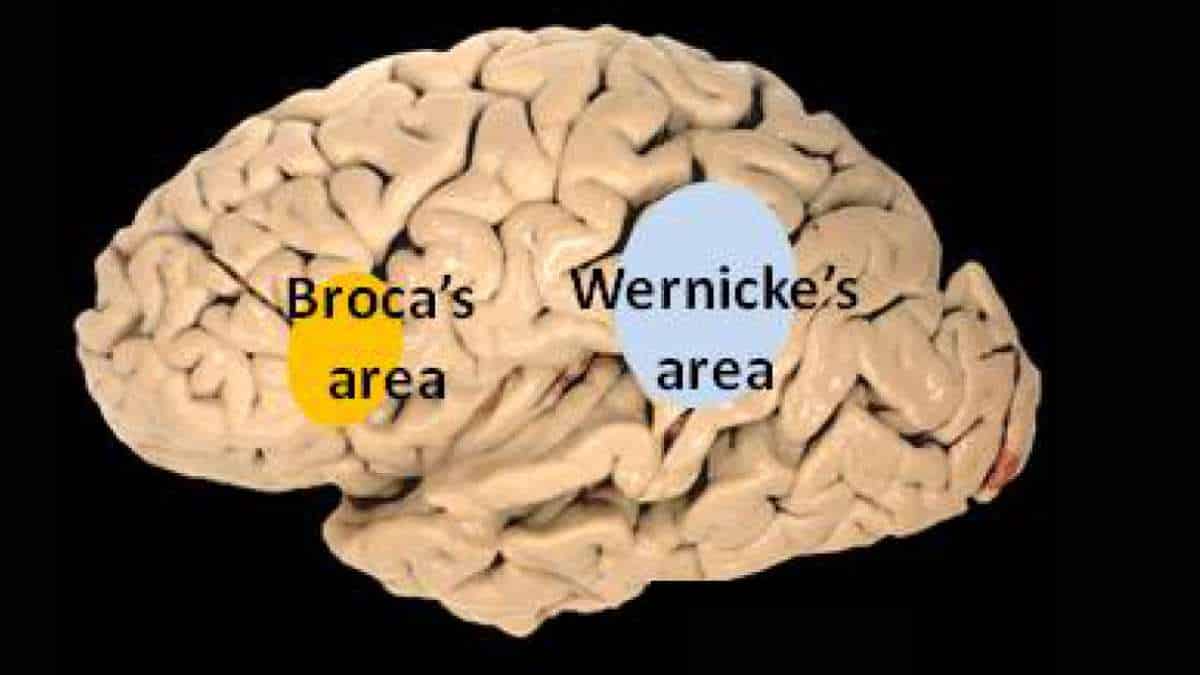 wernickes area