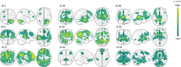 Neurofunctional underpinnings of individual differences in visual episodic memory performance