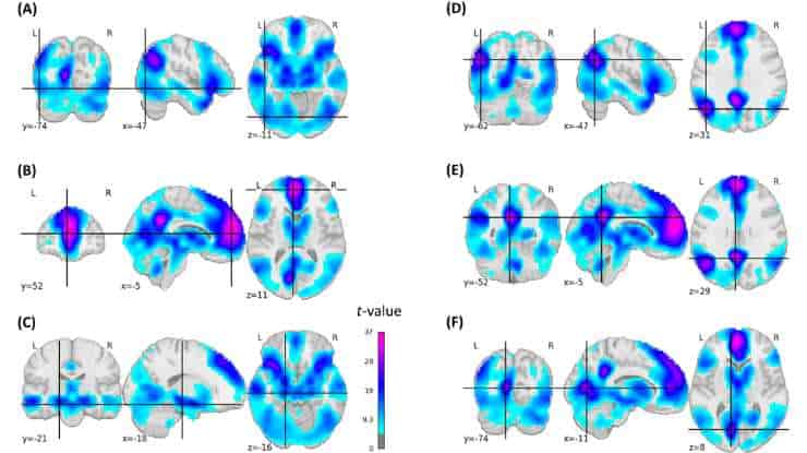 Brain's Episodic Memory Performance Signals