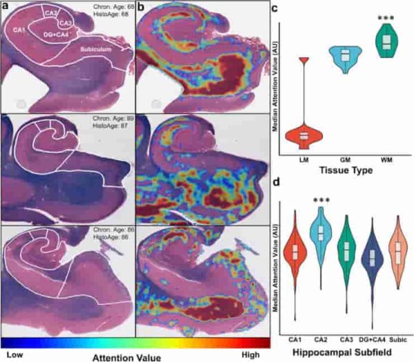 HistoAge model exhibits increased attention in vulnerable neuroanatomical regions