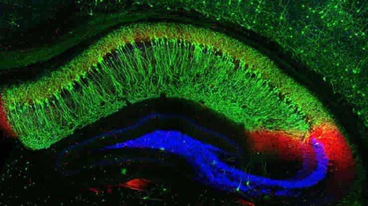 Mouse hippocampus cross section