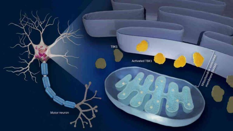 Research revealed that diminished activities of an enzyme called TBK1 in mitochondrial-associated membrane (MAM) reduces motor neurons' tolerance to stressors
